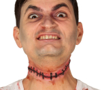 Overskåren hals, blodigt ar